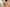 Back Acne (Bacne): Causes, Prevention, and Treatment