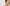 Cheek Acne: Why It Happens and What You Can Do