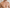 Chest Acne: Why It Happens and How to Clear It