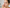 Nose Acne: Why Breakouts Happen Here